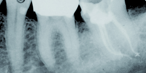 endodontie-1.jpg